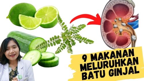 Jaga Kesehatan Ginjal dengan 7 Minuman Berikut Ini Minuman yang dapat membersihkan ginjal sebuah tinjauan komprehensif